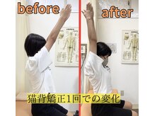 きずな鍼灸整骨院 武蔵ヶ丘本院/猫背矯正