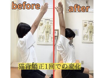 きずな鍼灸整骨院 武蔵ヶ丘本院/猫背矯正