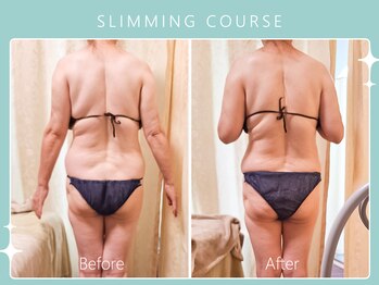 ハノハノ 八代店(HANO HANO)/選べる12種の痩身脂肪撃退☆