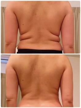 リクラ 北千住(Reclat)/９０分1回のビフォーアフター