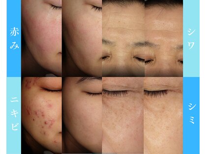 アンジェラックス スキンケアセンター心斎橋の写真