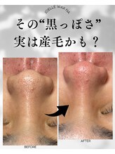 ジョエルワックス 沖縄那覇店(JOELLE WAX)/その鼻の黒ずみ実は産毛かも？