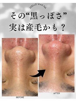 ジョエルワックス 沖縄那覇店(JOELLE WAX)/その鼻の黒ずみ実は産毛かも？