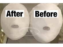 美極 トータルビューティー(美極 TOTAL BEAUTY)/恵比寿/小顔コルギ/エステ/