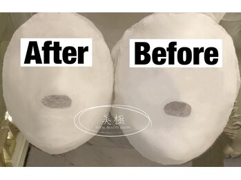 美極 トータルビューティー(美極 TOTAL BEAUTY)/恵比寿/小顔コルギ/エステ/