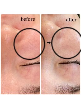 ラシック(Rachic)/