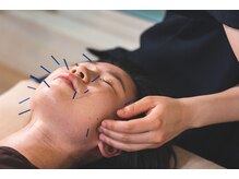 トリガー鍼灸 整体院 学芸大学駅前院(TRIGGER鍼灸 整体院)/フェイスラインが気になる方