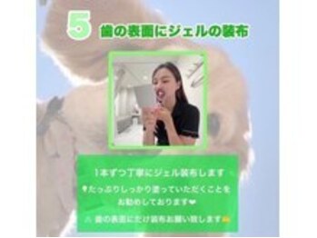 ホワイトニングショップ 吉祥寺2号店/ 【照射の流れ】5