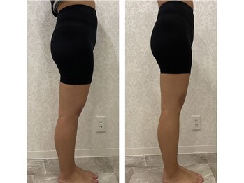 トラレス(Trouless)/ヒップUP効果