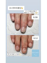 エオル(eol.)/自爪育成☆縦爪☆パラジェル☆