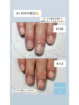 エオル(eol.)/自爪育成☆縦爪☆パラジェル☆
