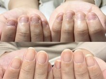 キュア(Cure.)の雰囲気（深爪・巻き爪などお悩みの爪を美しい爪に変身させるネイルサロン）