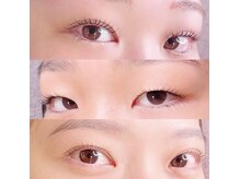 ミーティット(Meetite)