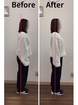 リライフ/Before/After