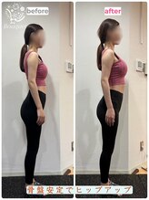 ブーケ 中野店(Bouquet)/お客様ビフォーアフター