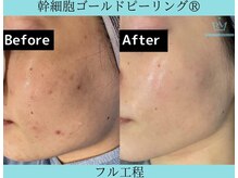 リメイク 広尾(REMAKE)/