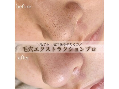 メメビューティー アンド ワキシング(meme beauty&waxing)の写真