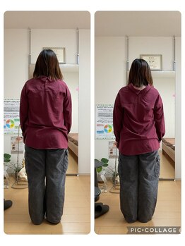 ファン スペース(Fun Space)/改善事例　20代女性　カイロ整体