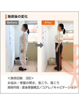 ただき接骨院 整体院 新前橋院/ お悩み：骨盤の開き、首肩凝り