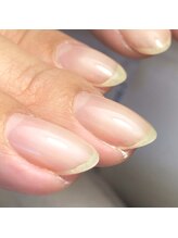 【土台から整える】守って育てる補強ジェルネイル