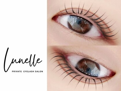 リュネル(Lunelle)の写真
