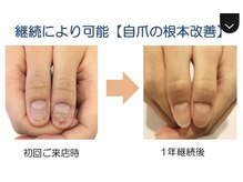 ローネイル(Raw nail)の雰囲気（日常生活に支障が出ないよう、削らずやさしく補強）