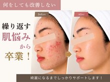 りりあす