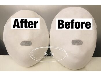 美極 トータルビューティー(美極 TOTAL BEAUTY)/恵比寿/小顔コルギ/エステ/