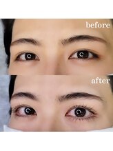 シルミエ(cilumie)/次世代ラッシュリフト（上下）