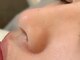 ミニョンプラス(Mignon+)の写真/最新毛穴洗浄で毛穴5ミリ深い汚れも取り除く今まで実感できなかったうる艶肌へ★ニキビケアにも◎