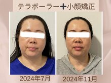 骨格美容サロン/小顔矯正