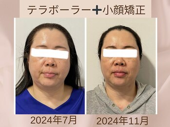 骨格美容サロン/小顔矯正