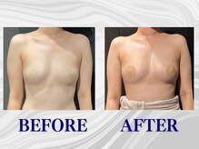 ザモア 福岡天神(THE MORE)/【症例 Before After】