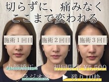 アズイズビューティー 草津店