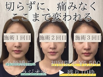 アズイズビューティー 草津店の写真