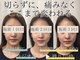 アズイズビューティー 草津店の写真