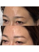 マナ ワクシング 海浜幕張(Mana waxing)/似合わせ美眉ワックス/海浜幕張