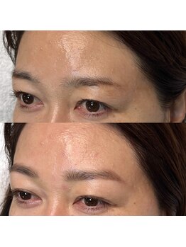 マナ ワクシング 海浜幕張(Mana waxing)/似合わせ美眉ワックス/海浜幕張