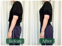 まっさ鍼灸整骨院 京王堀之内院/産後におすすめ骨盤調整