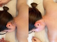 ニナ コレクション 那覇おもろまち店(Nina collection)の雰囲気(うなじ/もみあげ/肩/背中のWax脱毛もおすすめ♪)