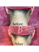 ベルミーランド MEGAドン・キホーテ四街道/うなじ・襟足脱毛