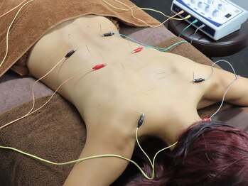 ムイ(mui)/身体鍼☆