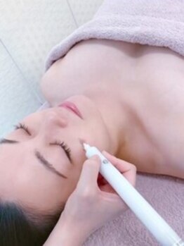 カンパニュラ(campanula)の写真/【話題の低周波シミケア】低刺激/ダウンタイム無し/当日からメイクOK！/季節問わず施術OK！