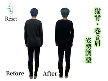 リセット(Reset)の雰囲気（猫背/巻き肩/姿勢調整も一緒に行います）