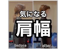 カワル整体 上通り院/肩の膨隆が気になる人