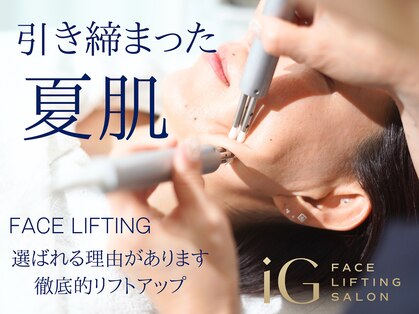 アイジー(iG)の写真