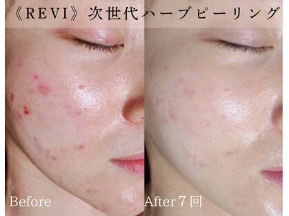 インディビューティー 六本木店(inde beauty)の写真