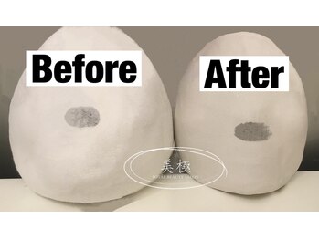 美極 トータルビューティー(美極 TOTAL BEAUTY)/恵比寿/小顔コルギ/エステ/