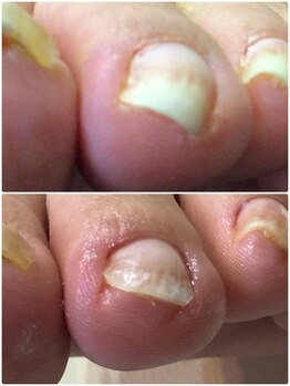 モアクリスタル(More Crystal)/