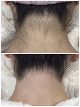 ベルネージュ(Belle Neige)/